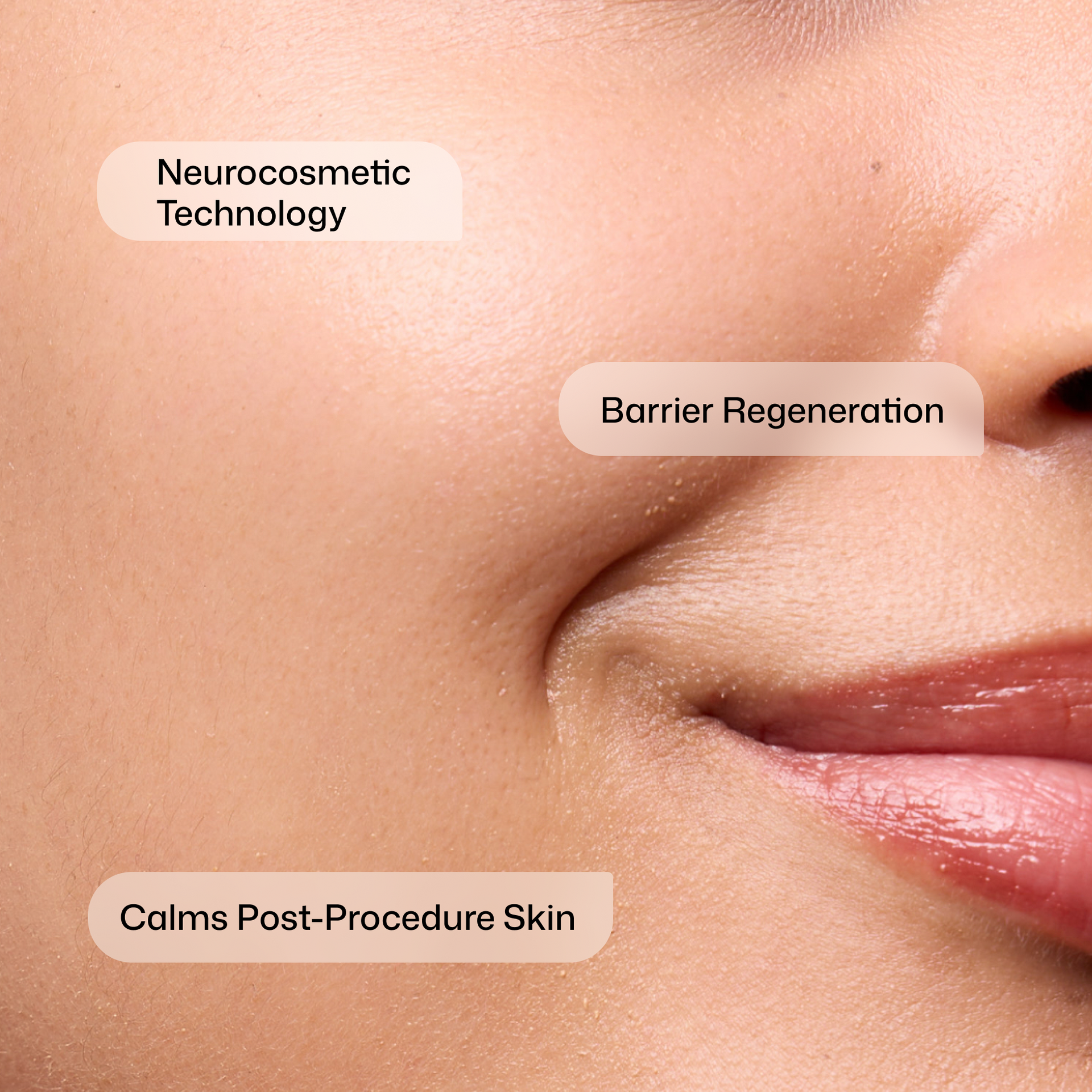 CMT Post-Procedure Cream™