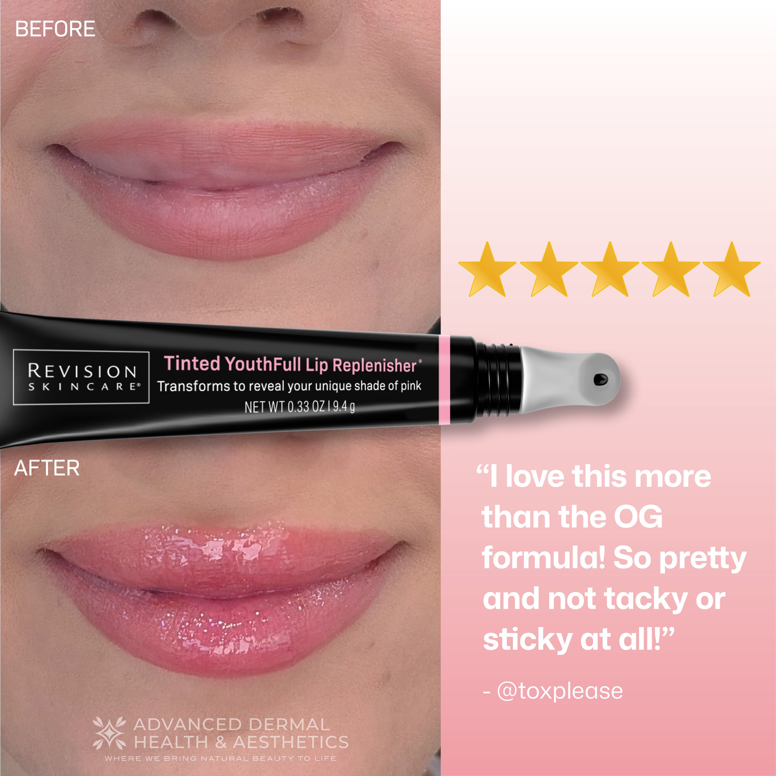 Tinted YouthFull Lip Replenisher | Revision Skincare Lip Solution